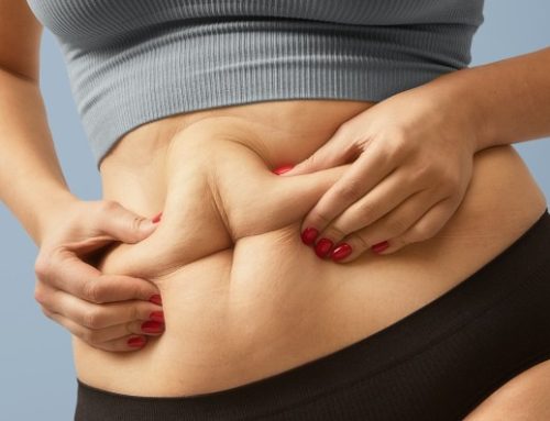 Grasa visceral: ¿cómo eliminarla?